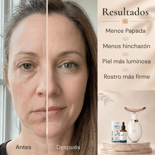 RITUAL LIFTING BLOOM™ - Terenya